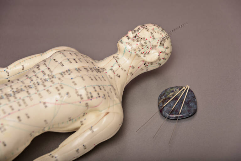 Acupuncture par stimulation électrique