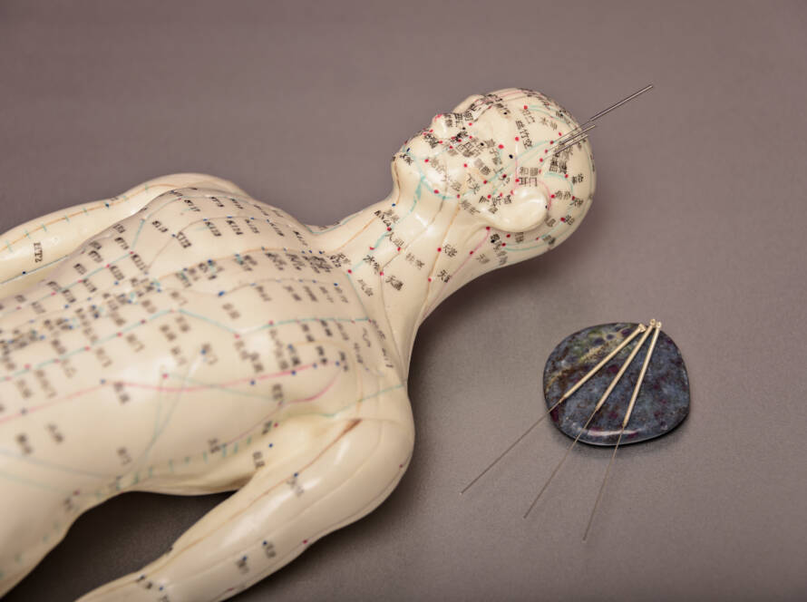 Acupuncture par stimulation électrique